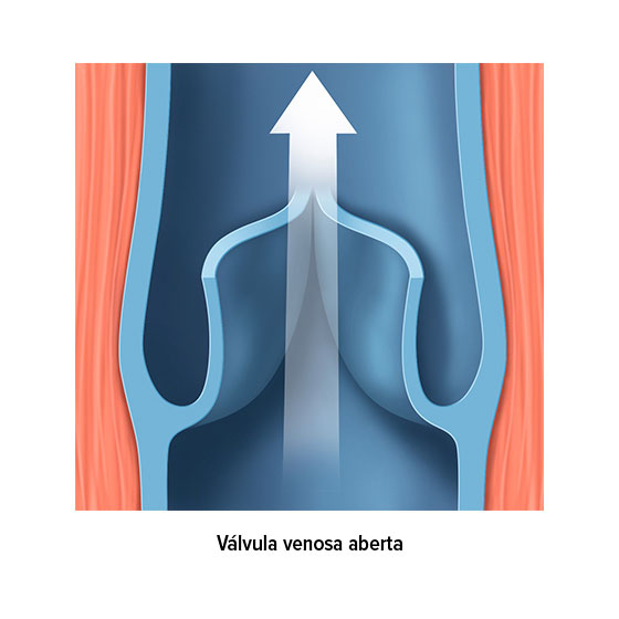 Válvula venosa aberta Válvula venosa aberta