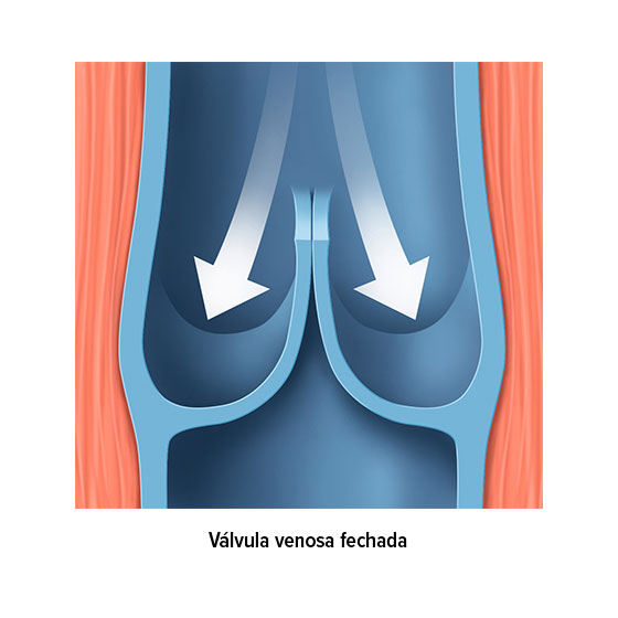 Válvula venosa fechada Válvula venosa fechada