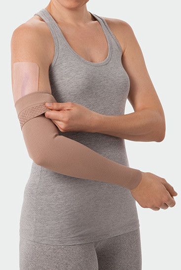 Juzo ScarPad, in combination with compression on the arm