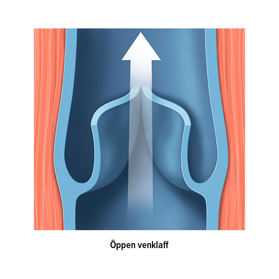 Öppen venklaff Öppen venklaff