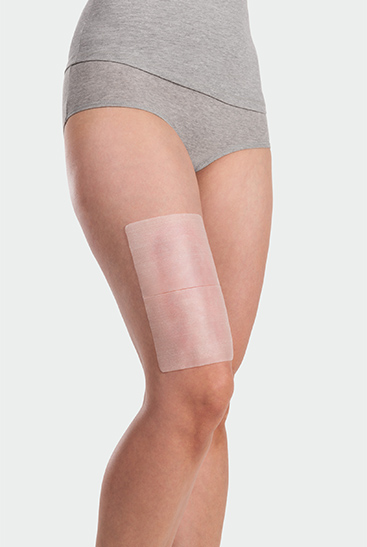Juzo ScarPad, application on the thigh Juzo ScarPad, application on the thigh