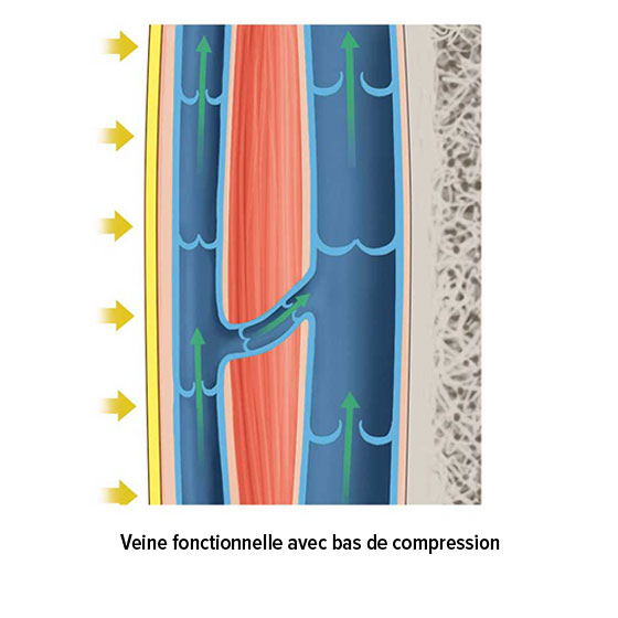 Veine fonctionnelle avec bas de compression Veine fonctionnelle avec bas de compression