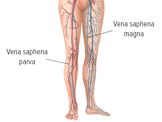Representação gráfica da veia superficial da perna e da veia profunda da perna Representação gráfica da veia superficial da perna e da veia profunda da perna